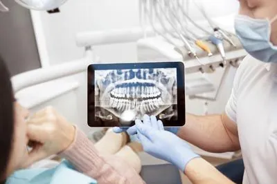 Full-mouth X-ray technology used at Acre Wood Dental - Gatesville