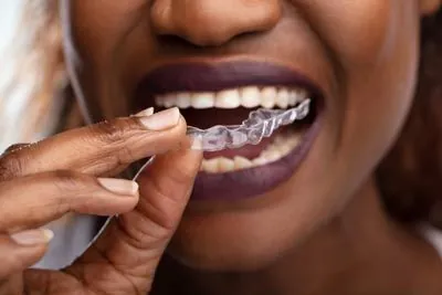 woman putting in her clear aligners from Acre Wood Dental - Gatesville