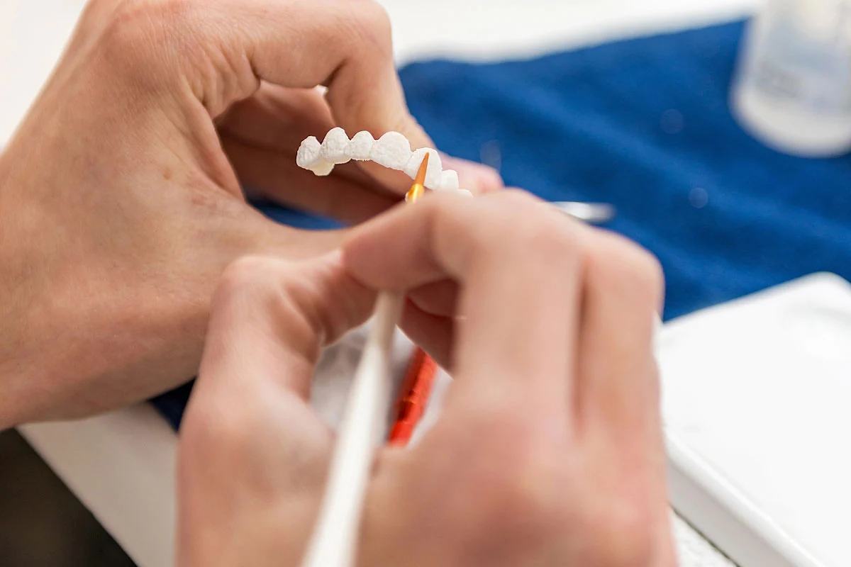 dentures can restore your smile at Acre Wood Dental - Temple
