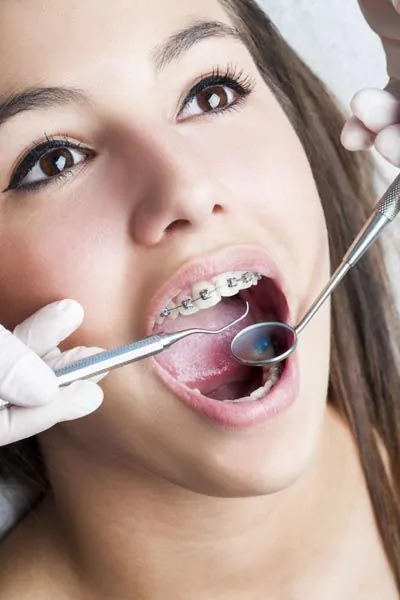 young girl with braces getting dental care at Acre Wood Dental - Waco