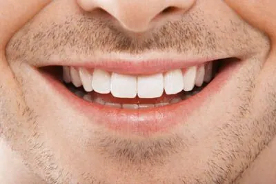 man's clear smile after a gingivectomy in Waco, TX