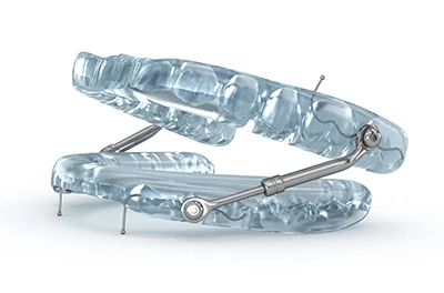 appliances used to treat sleep apnea